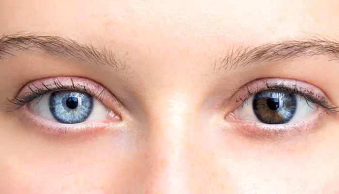 Do You Know Why We Have Different Eye Colors?
